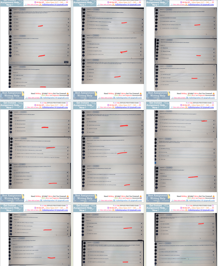 NR507 Week 8 Final Exam Due 25th June 2025 NR 507 Advanced Pathophysiology Complete Question 1-100 (Actual Exam Proctored via Examplify) With Correct Answers | 100% Pass Guaranteed | Graded A+ | - Your Assignment Handlers (Bypass_proctored_Exams)