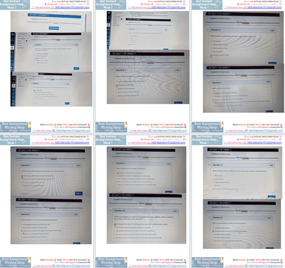 NURS6521 Week 6 Midterm Exam Complete Questions 1-101 Actual Online Exam NURS 6521N, Advanced Pharmacology Exam Questions and Answers - Your Assignment Handlers (Bypass_proctored_Exams)